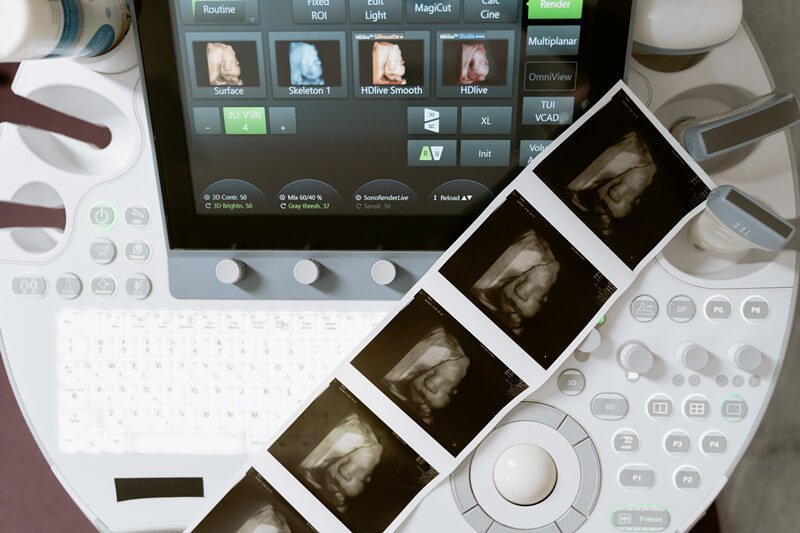 medical ultrasound image